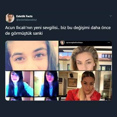 Ayça Çağla Altunkaya estetiksiz