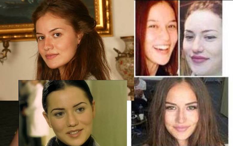 fahriye-evcen-estetiksiz-hali-2