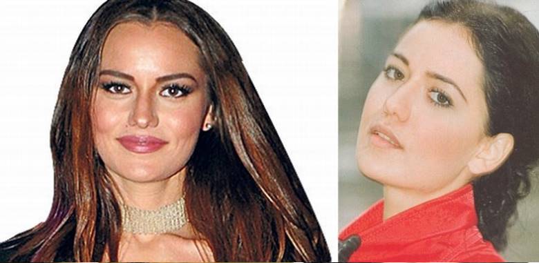 fahriye-evcen-estetiksiz-hali-3