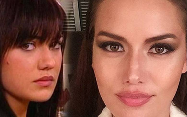 fahriye-evcen-estetiksiz-hali-4 Fahriye Evcen kimdir? Fahriye Evcen estetik doktoru kim? Fahriye Evcen burun estetiği oldu mu? Çene estetiği, diş estetiği ve göz kapağı ameliyatı oldu mu?