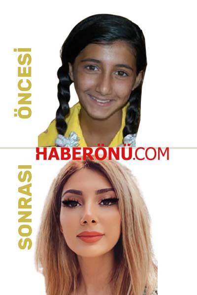 melodi-bozkurt-estetiksiz-hali Melodi Bozkurt estetiksiz hali
